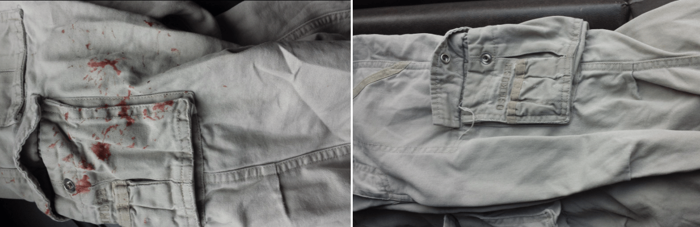 gum removed from clothing (before and after)